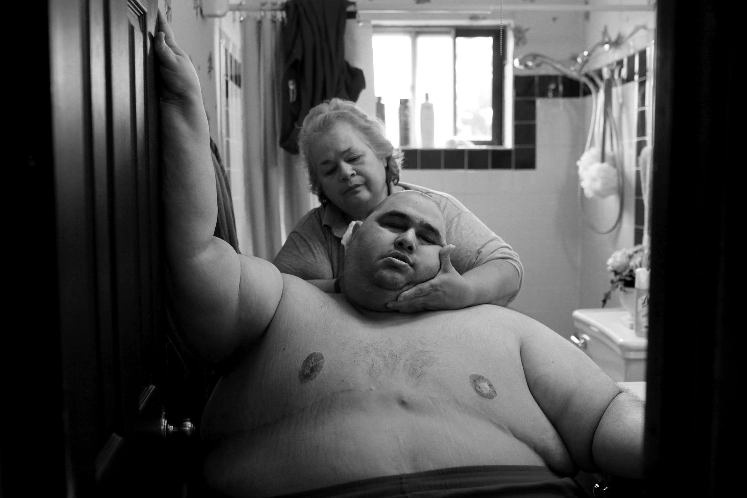 STORY SUMMARY: For most of his life, Hector Garcia Jr. battled severe obesity and all its consequences: the pain, the ridicule and the lost hopes. Bullied and ostracized as a child, he turned to food for comfort early. Hector lives in San Antonio, Texas, a city that has a place on Òfattest cityÓ lists every year. Recent figures from Gallup show the city has the second-highest obesity rate among major U.S. cities. 31 percent of San Antonians are obese and 65.7 percent of adults in the county are overweight or obese. Despite San AntonioÕs efforts to curb obesity, an untold number of people with severe obesity live in isolation like Garcia, unable to find or access the medical and psychological help they need to combat its pervasive effects. After years of repeatedly gaining and losing hundreds of pounds, Garcia, who at one point weighed 636 pounds, once again was stuck in the back bedroom of his parents' modest house. In 2010, Garcia renewed his effort to lose weight. With only diet and exercise, he lost over 300 pounds, in hopes of receiving double knee replacement surgery he thought would change his life dramatically for the better. Two surgeries turned into four and Garcia was unable to exercise. He grew depressed and once again turned to food as comfort. Over the next year, Garcia regained the weight he had fought so hard to lose, continuing the cycle of obesity. CAPTION: At almost 600 pounds, Hector Garcia Jr. finds simple daily tasks like bathing a challenge. He struggled to walk across the hall from his bedroom to the bathroom so that his mother, Elena, could wash him after cutting his hair in November 2010. A month before, Hector started dieting after he realized he was close to his highest known weight, 636 pounds.